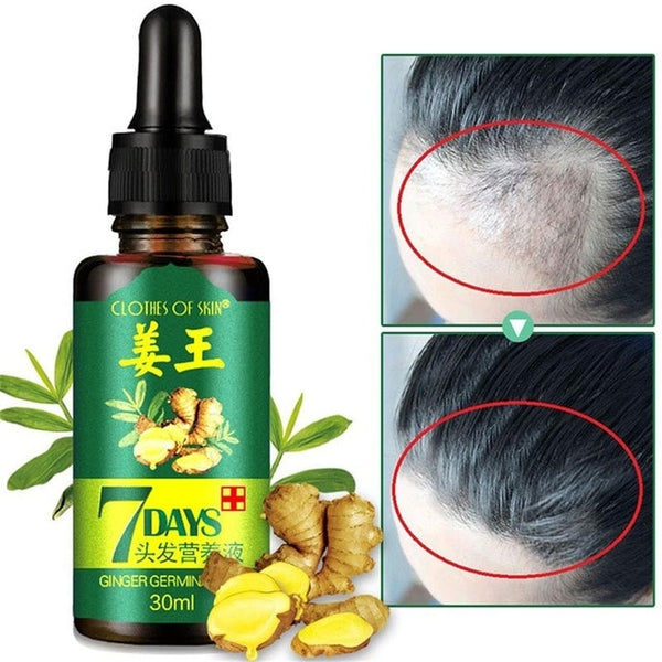 30ml Hair Re-grow 7 Day Ginger Germinal Serum Essence Oil Treatment Growth Hair Products Hair Loss Care Series Unisex TSLM1